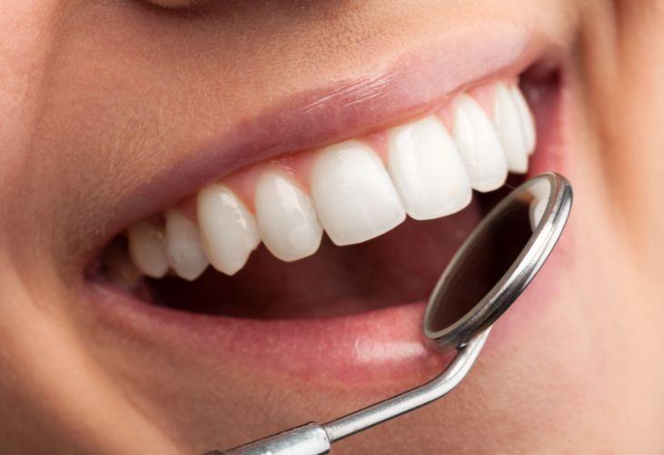 Dentística Estética – Maceió AL