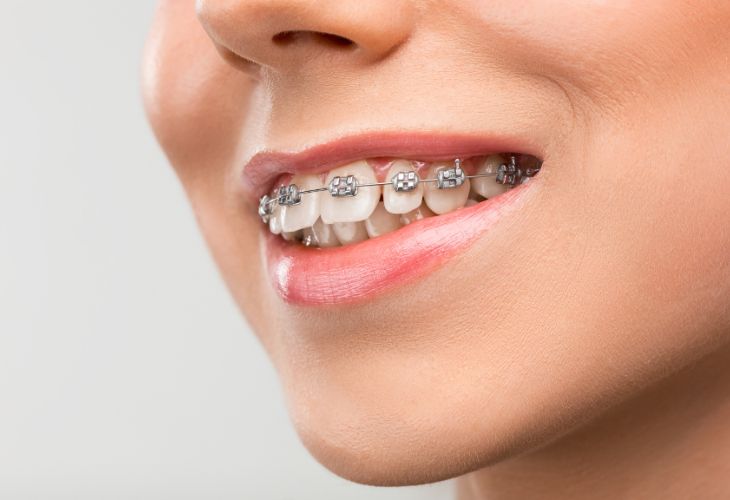 Ortodontia – Maceió AL
